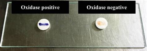 e.coli oxidase test